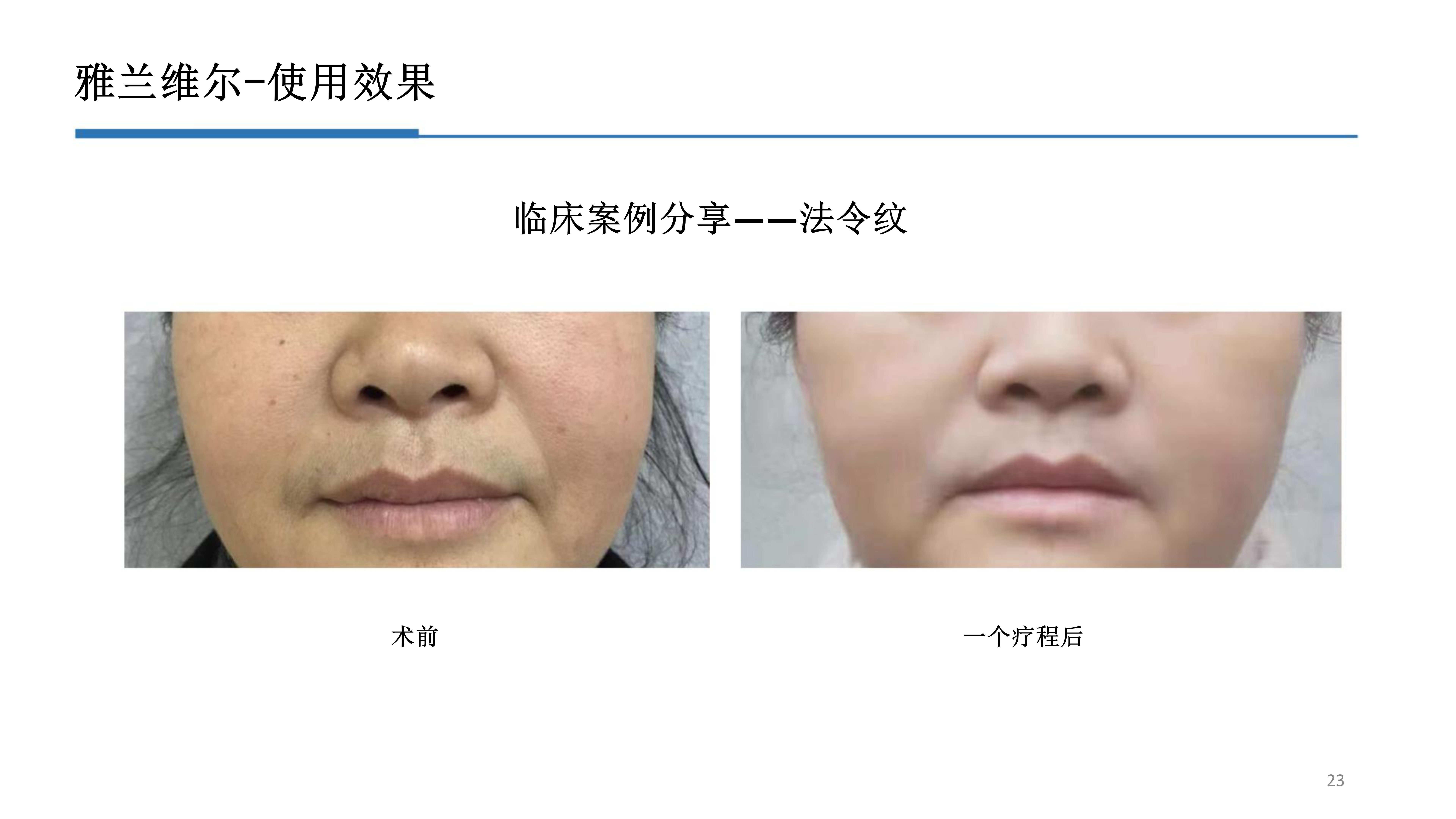 2-雅兰维尔_23.png