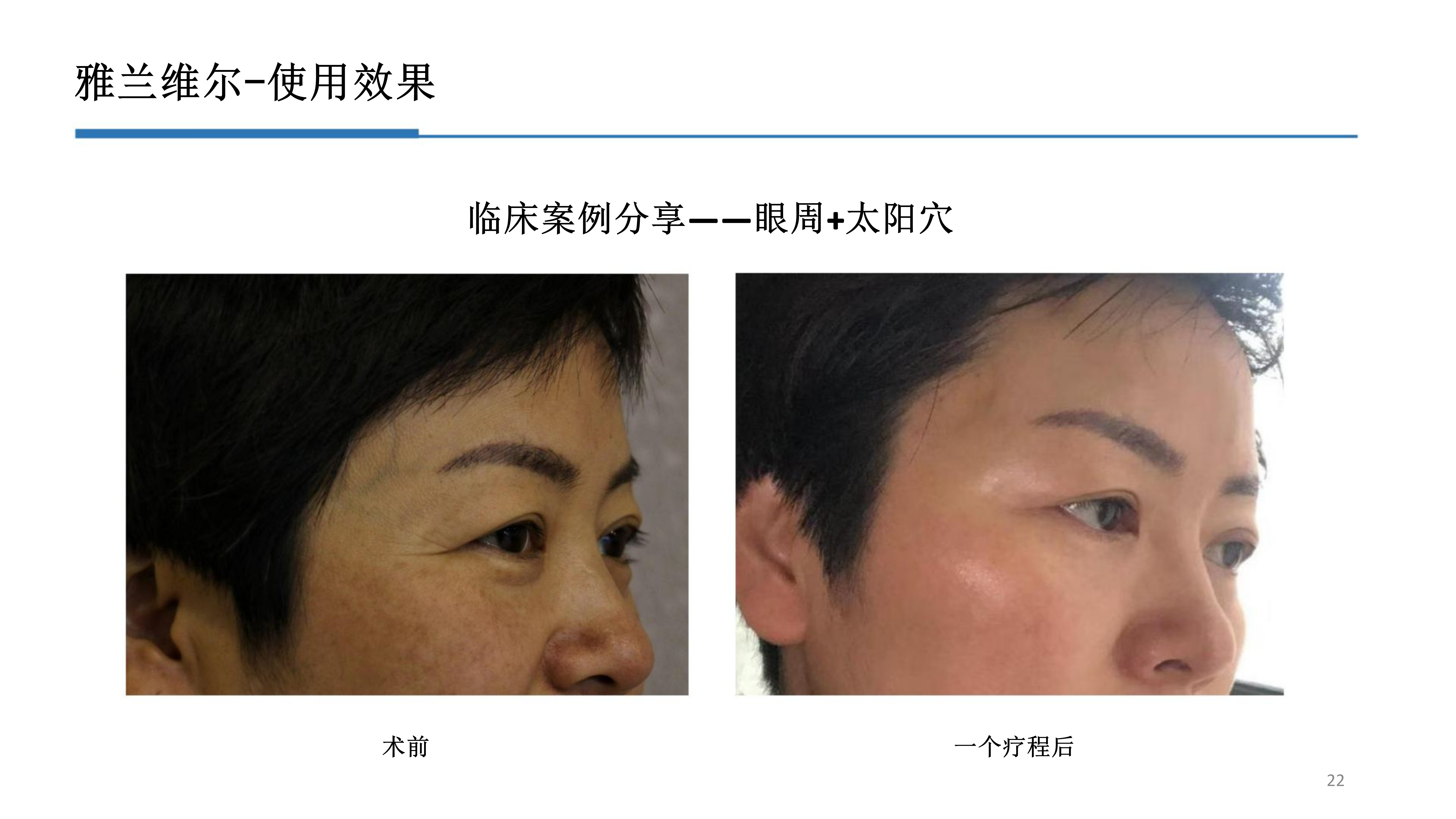 2-雅兰维尔_22.png