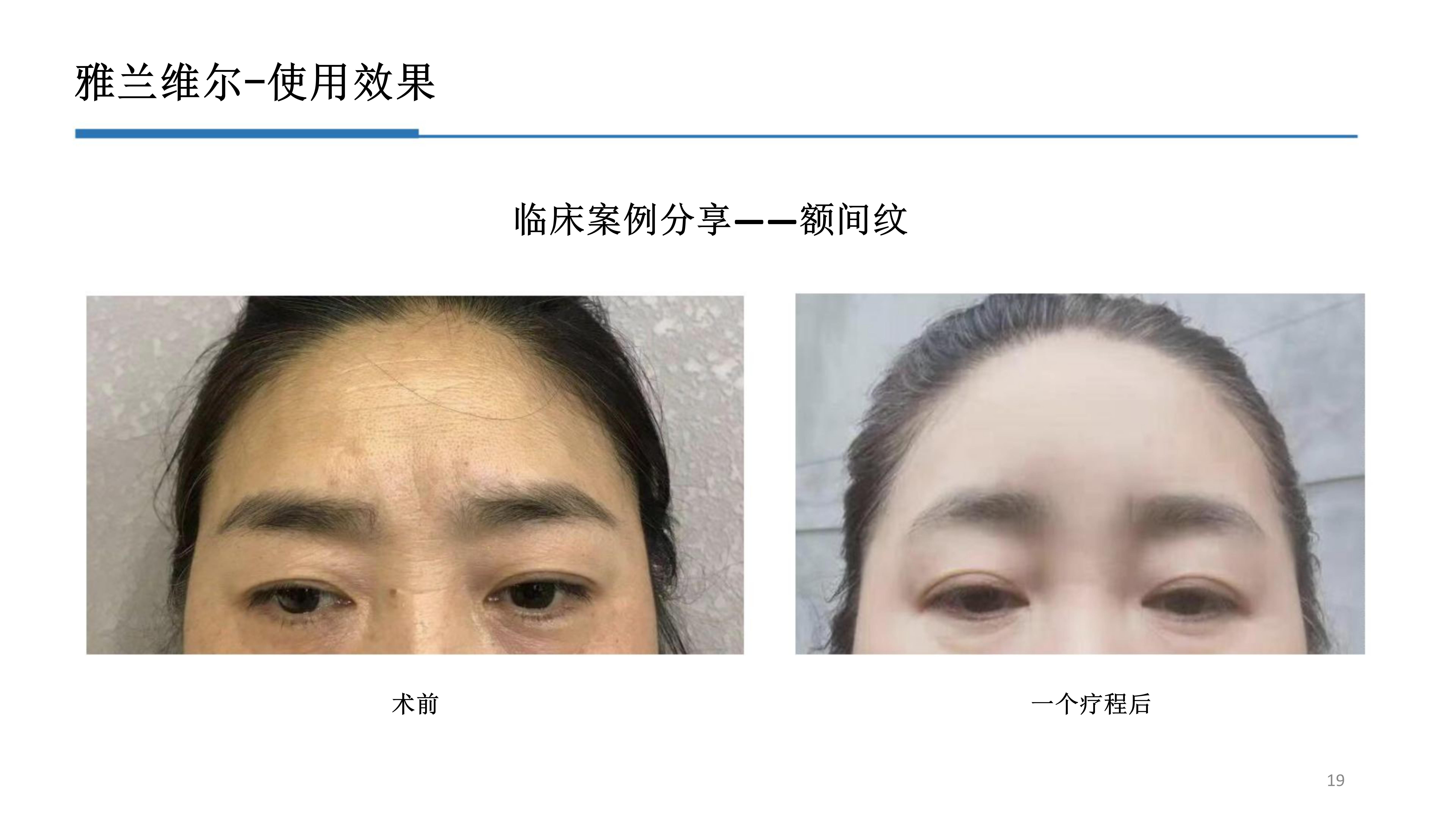 2-雅兰维尔_19.png