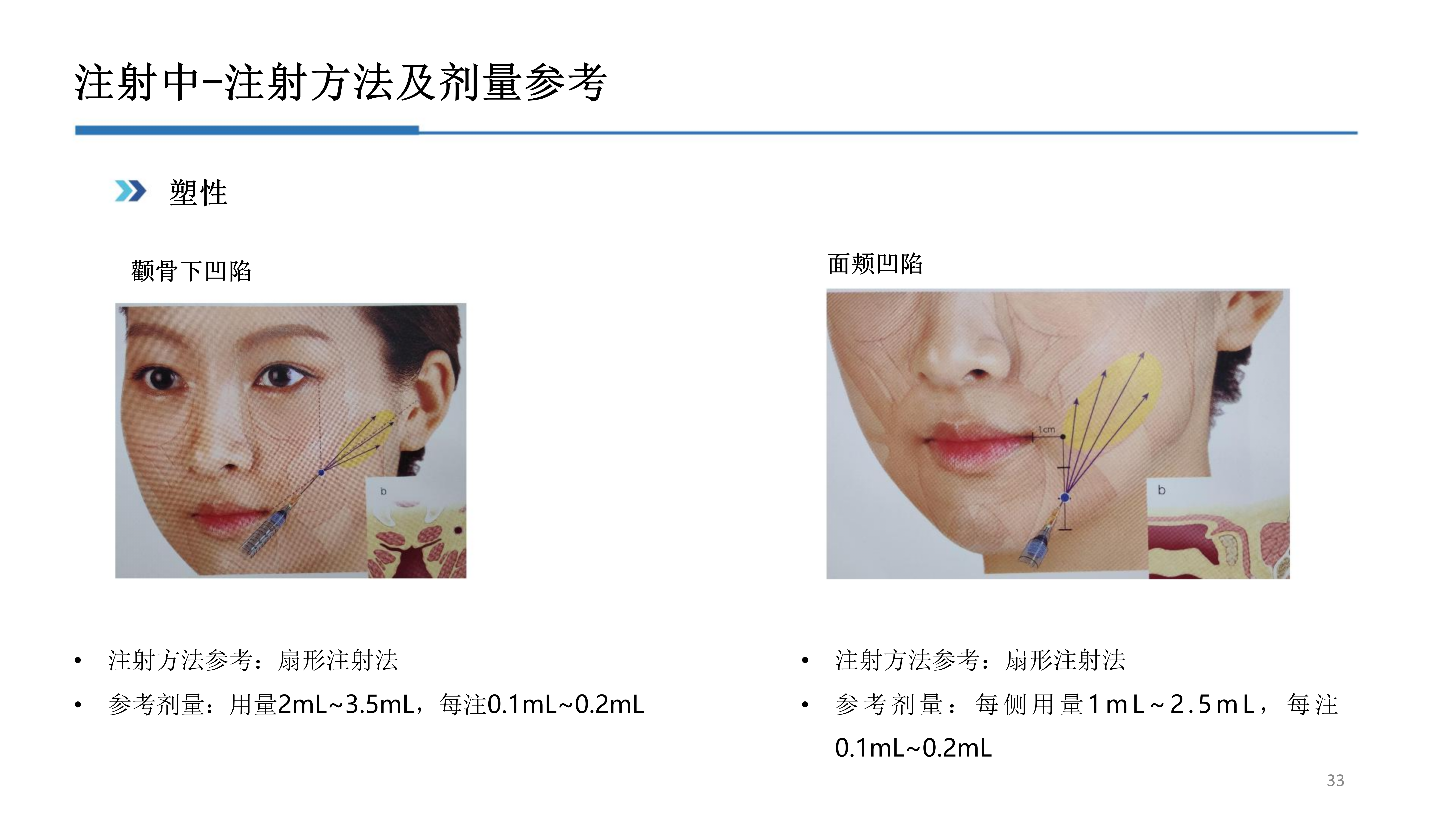 2-雅兰维尔_33.png