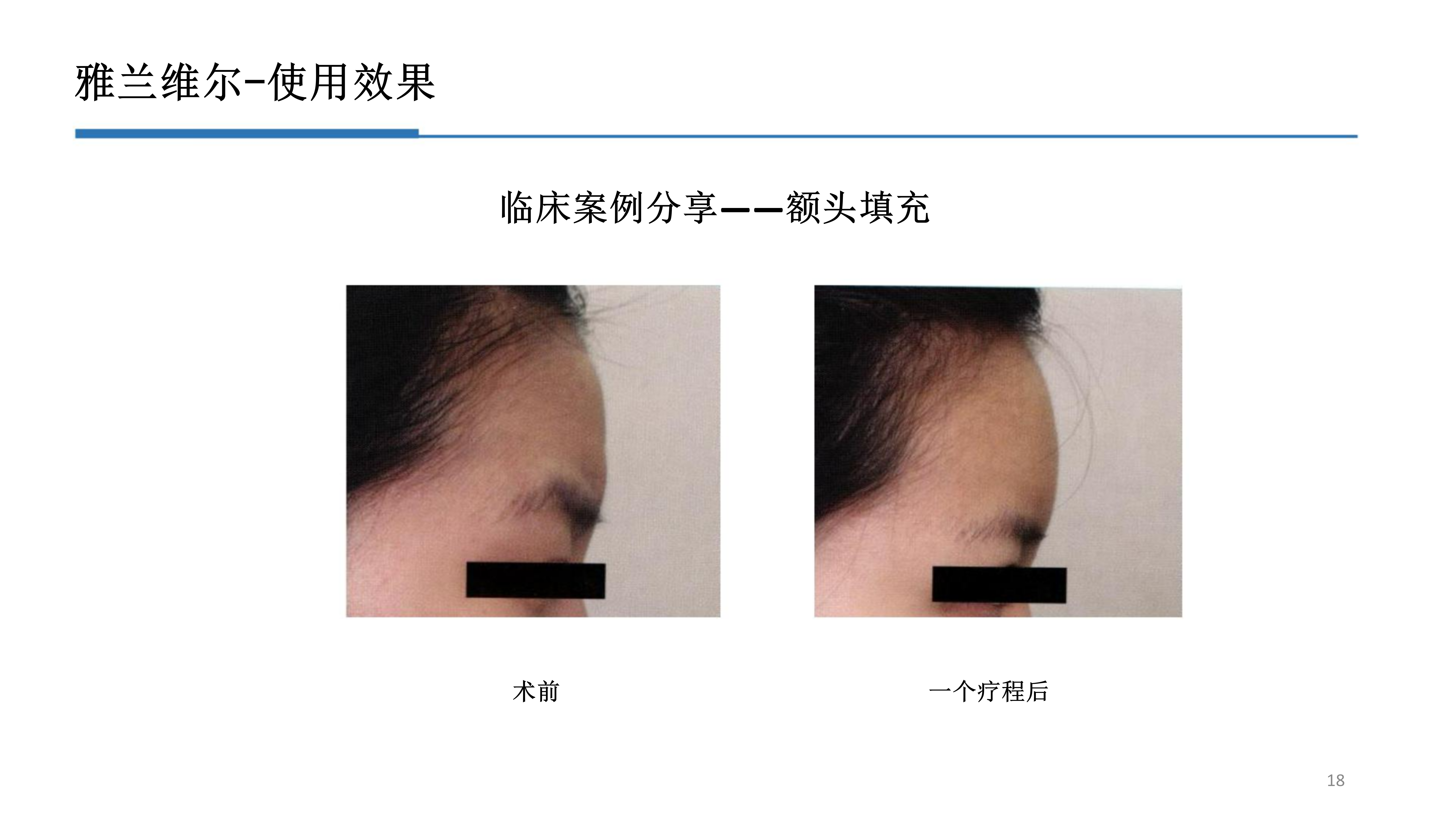 2-雅兰维尔_18.png