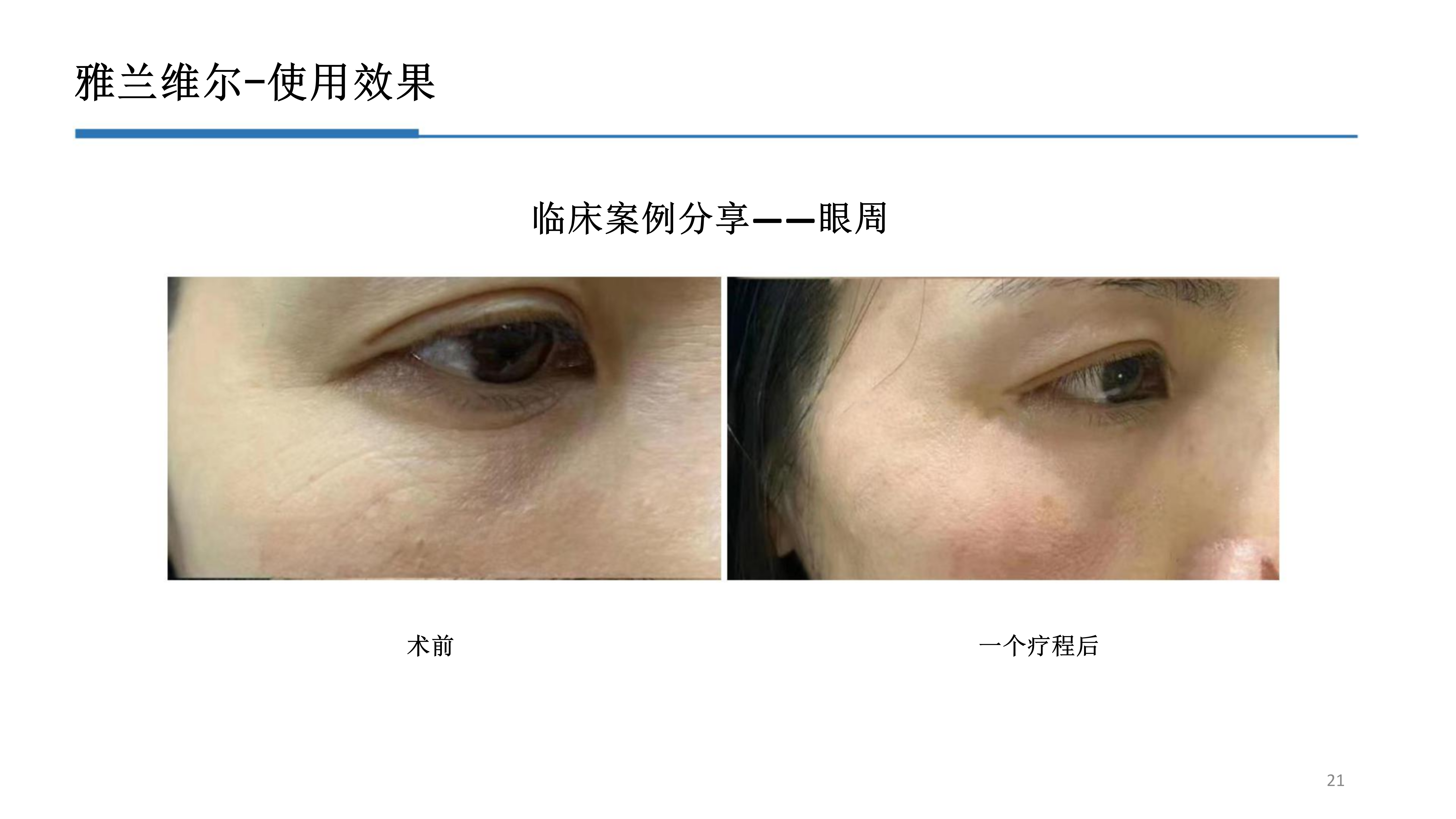 2-雅兰维尔_21.png