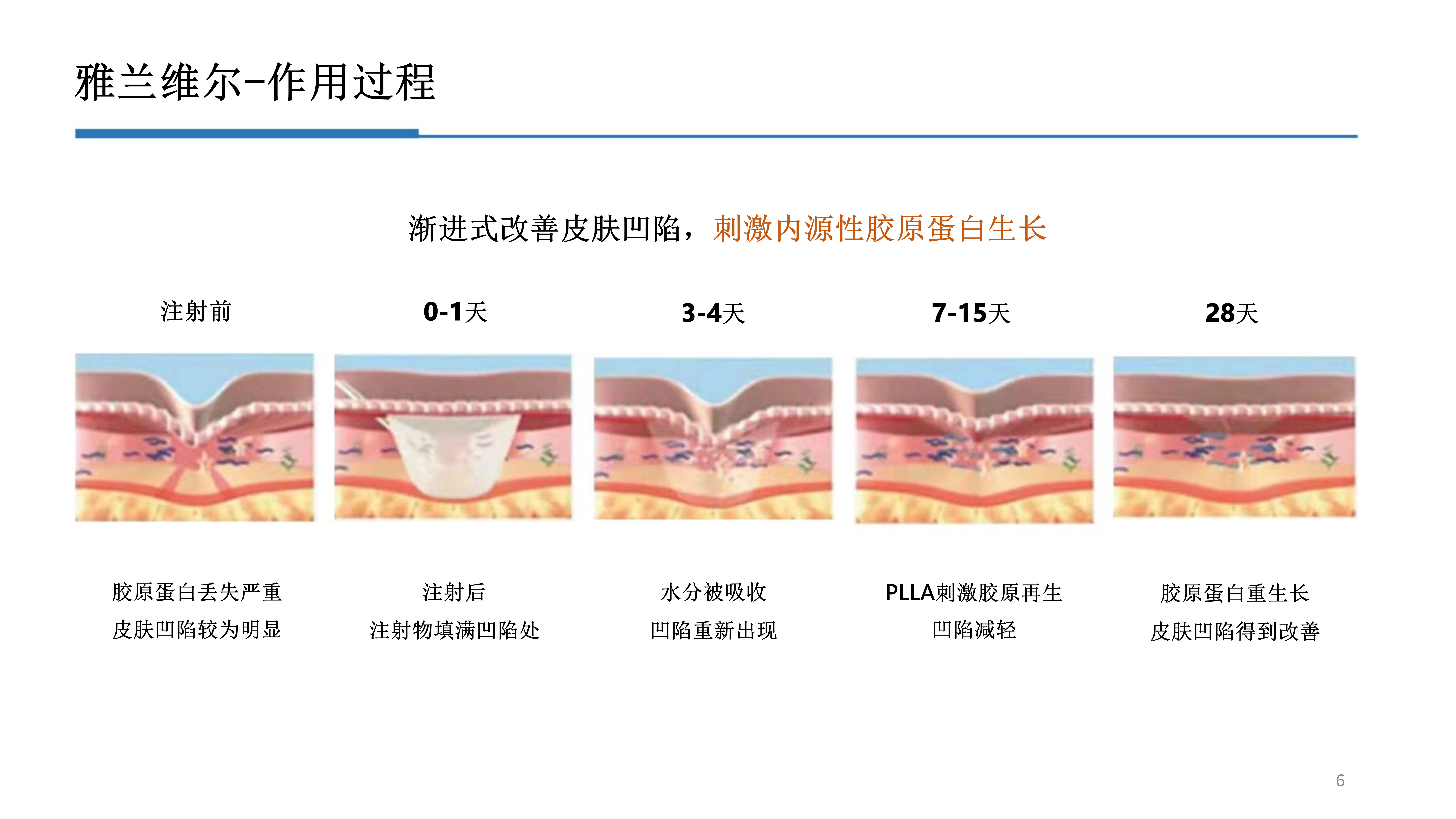 2-雅兰维尔_06.png