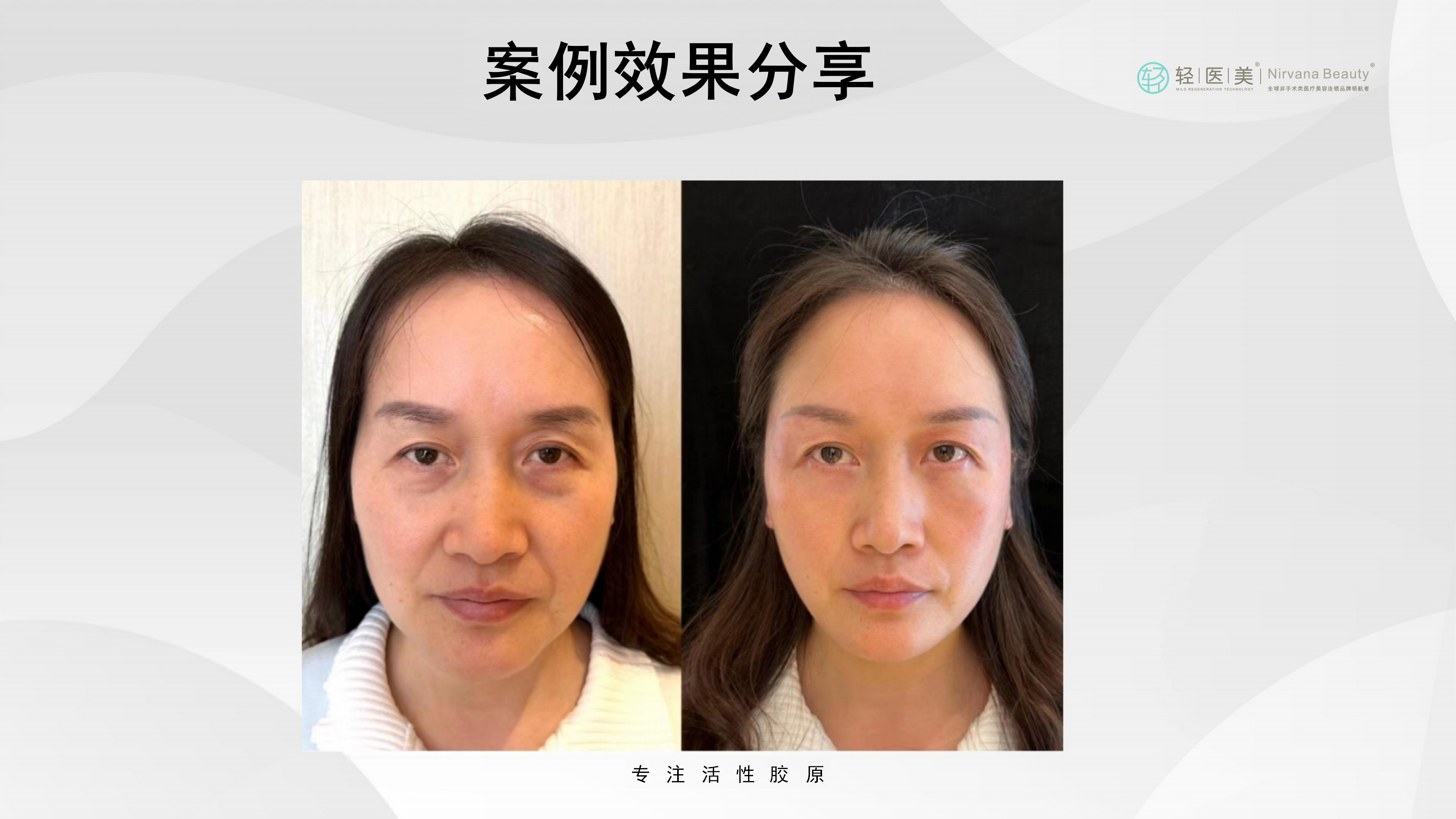 5-轻医美活性胶原系列产品_33.png
