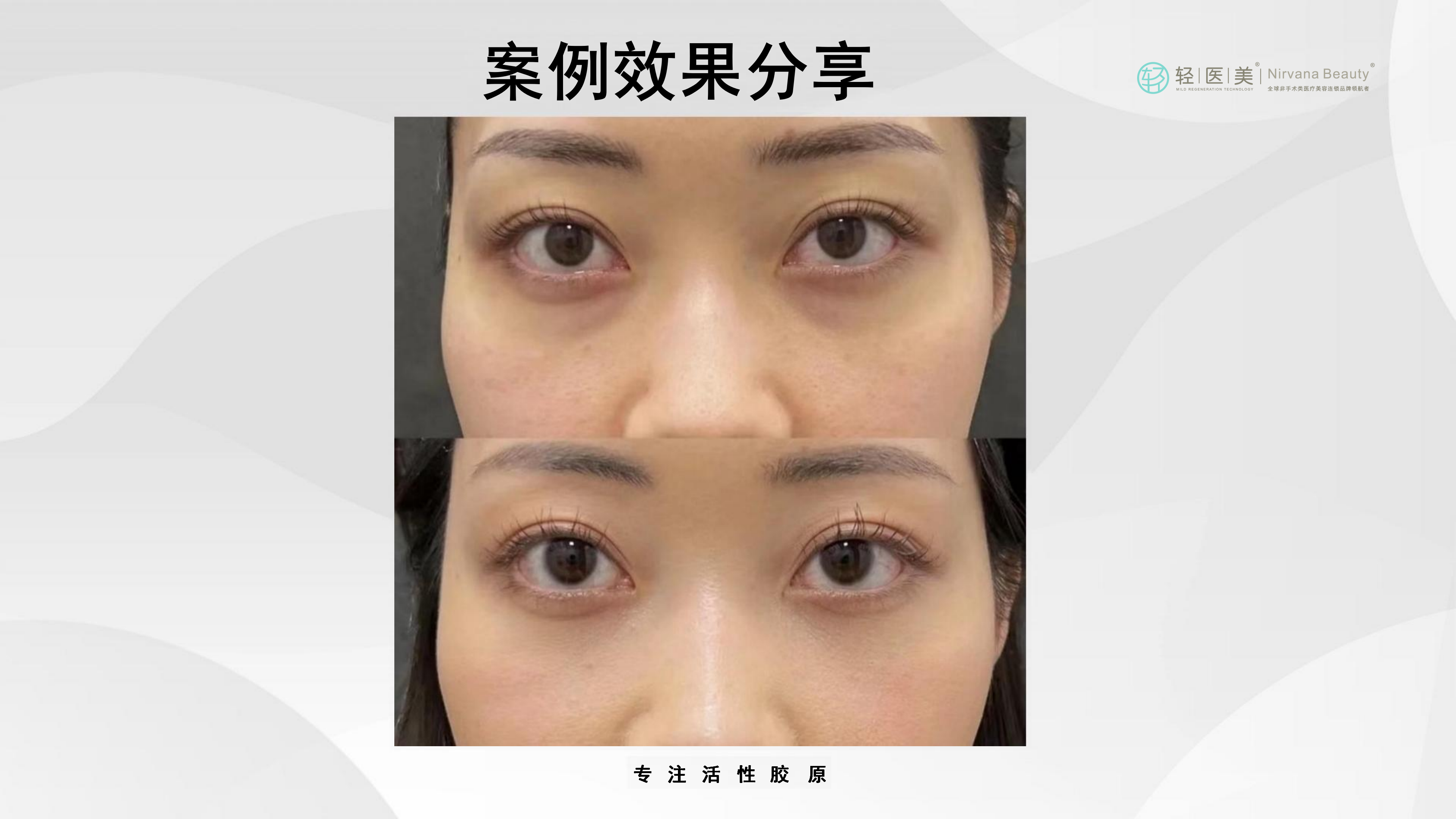 5-轻医美活性胶原系列产品_32.png