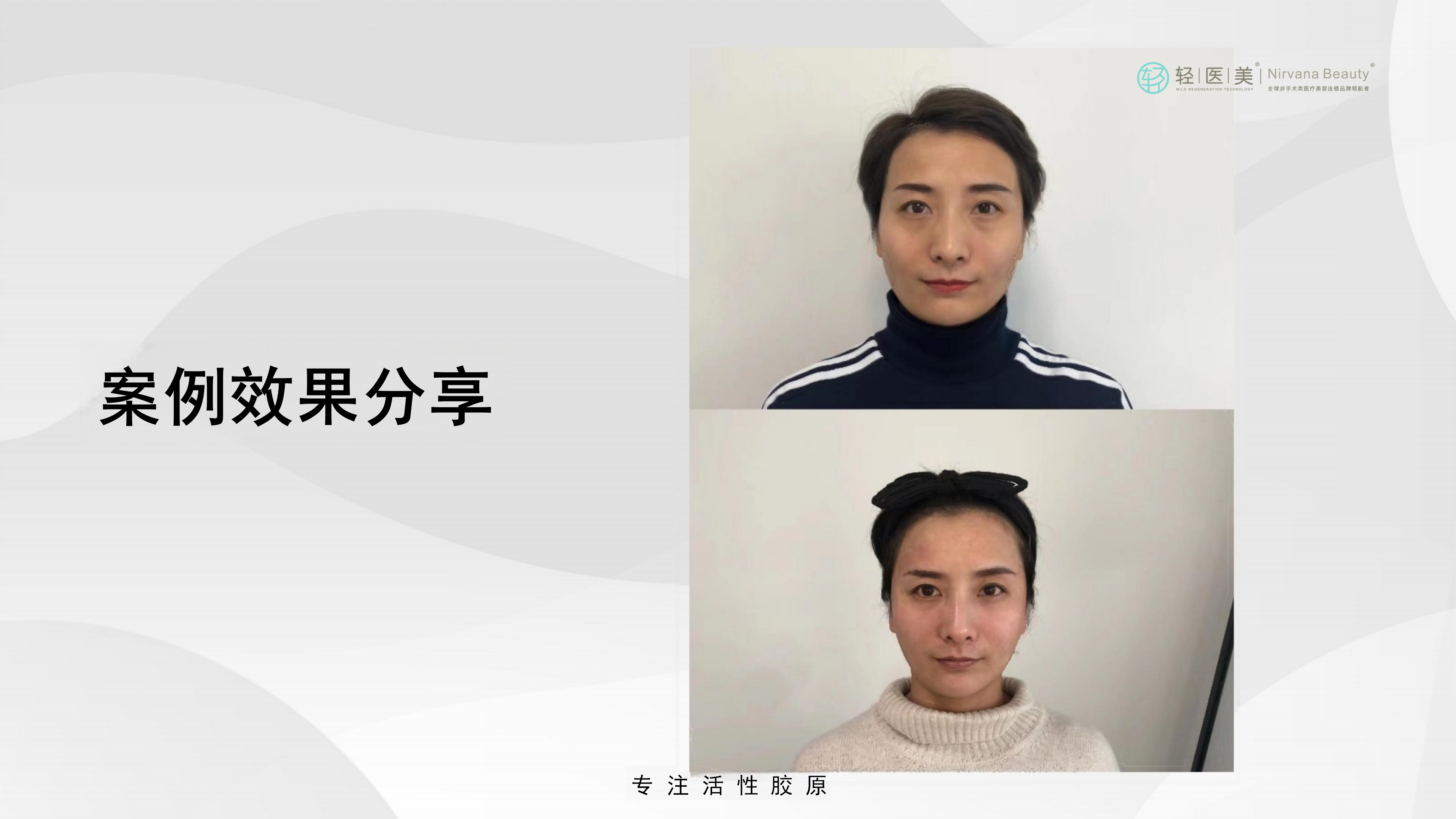 5-轻医美活性胶原系列产品_34.png