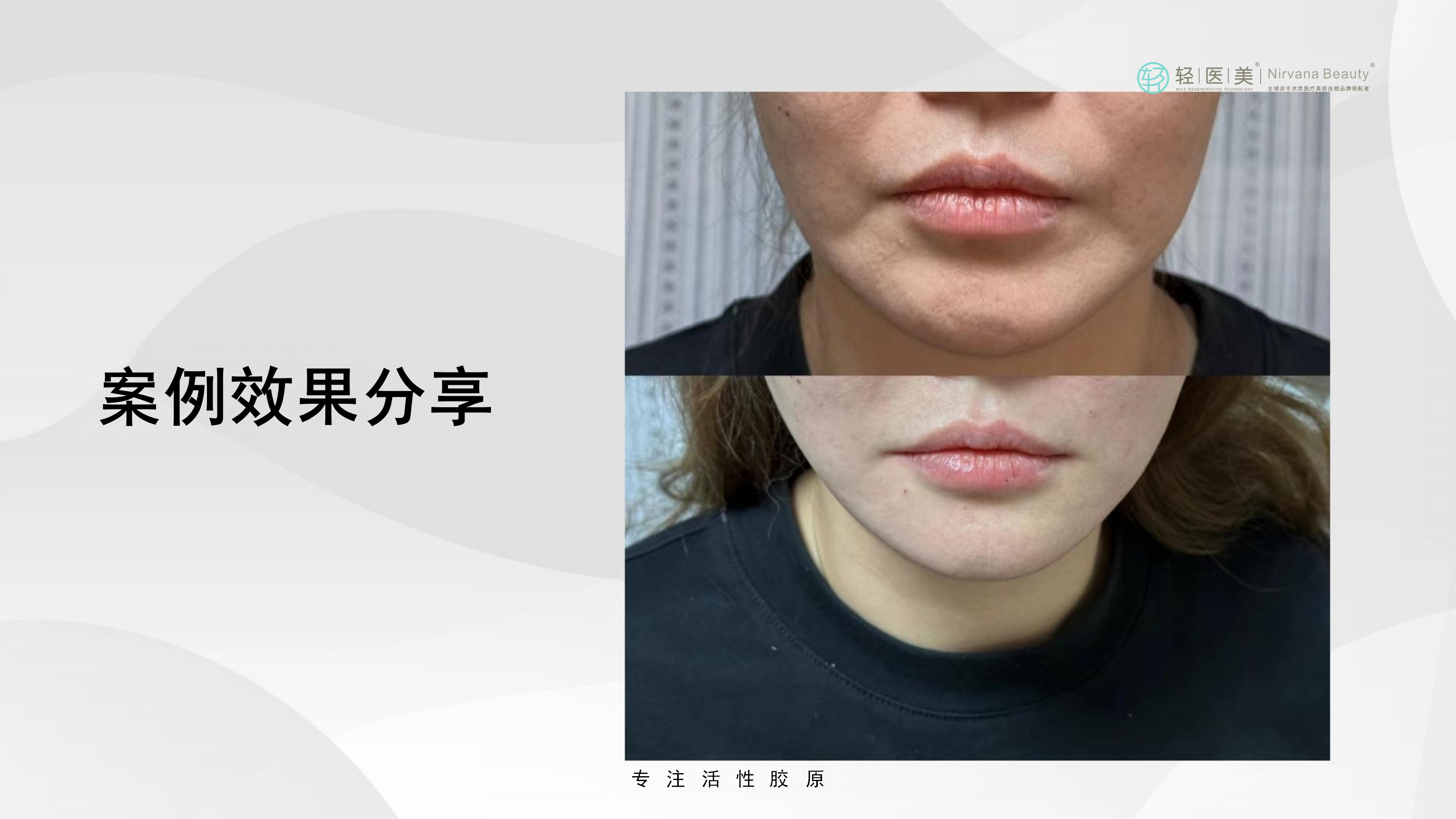 5-轻医美活性胶原系列产品_35.png